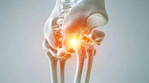 Hüftprothese Spezialist Graz